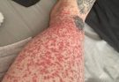 These are the consequences of sleeping with…See more