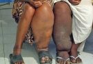 These are the consequences of sleeping with a… See more